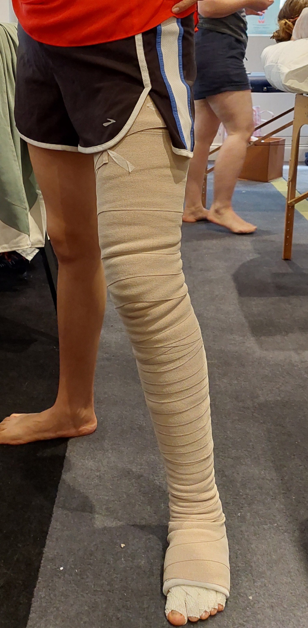 Compression bandages